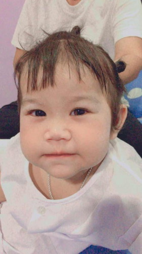 1ขวบ1เดือนฟันยังไม่ขึ้น