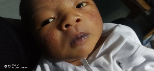 10 Days Old
