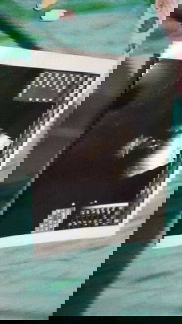 Bun ada yg bisa bantu jawab g...ak dua kali USG di bedan yg berbeda kok beda pula jawabnya..