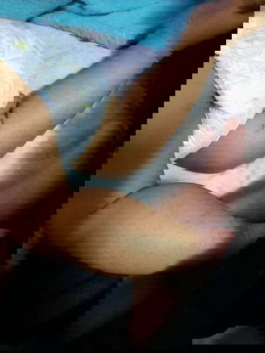 มือเท้าปาก