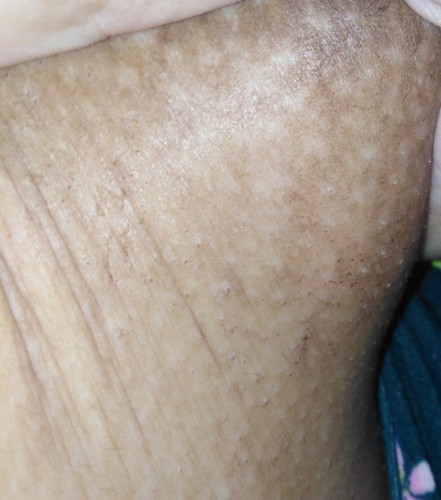 NAGBABALAT ANG BREAST AT SUPER KATI