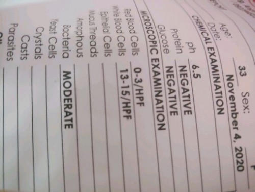 urine results