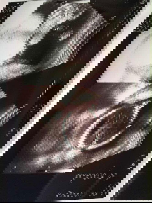 Usia kandungan maju 20w jadi 23w