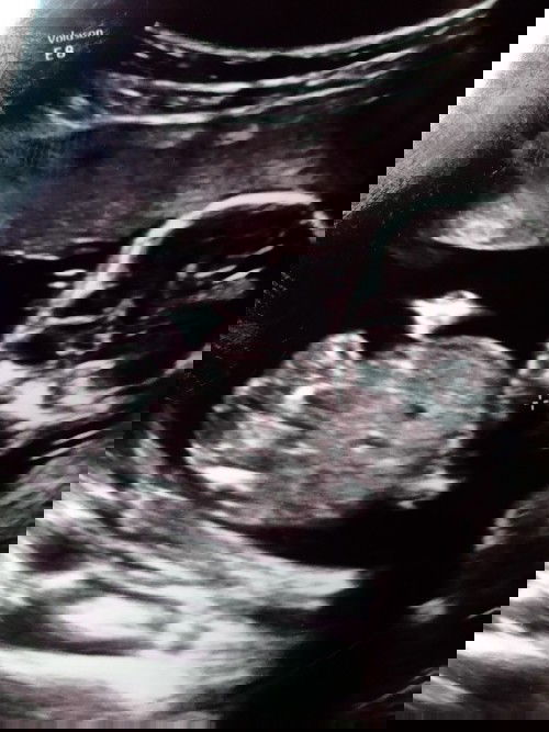 หมอบอกไม่รู้เพศ