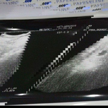 Apa aku hamil BO lagi?