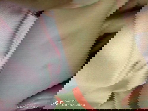 BEKAS GIGITAN SERANGGA