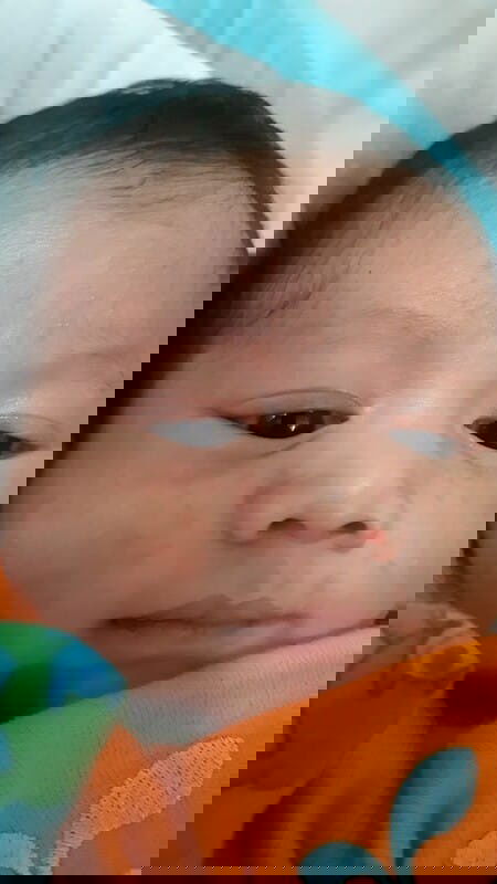 Muka tertadapat ruam kemerahan