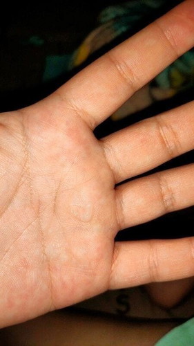 อันนี้คือมูกหรือ ตกขาวค่ะ