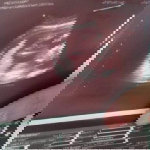 It's a boy 🎉❤😍