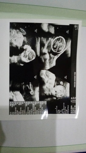 20 weeks 3 days