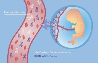 Các Mom đã làm xét nghiệm NIPT cho mình hỏi chỉ số nào trên bảng để giới tính thai nhi như thế nào?