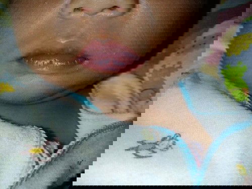 Bibir bayi kering Dan menghitam
