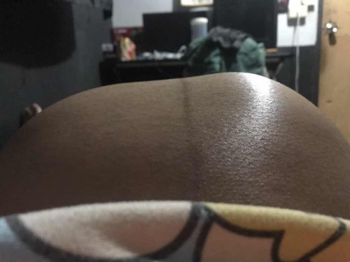 37+2 มีอาการเเบบนี้