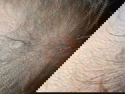 ลูกน้อยมีตุ่มขึ้นที่หัว ตามรูปเป็นอะไรไหมคะ ขึ้นช่วงข้างหน้าเยอะมากคะ