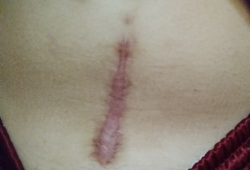 Delivery via CS 4months ago