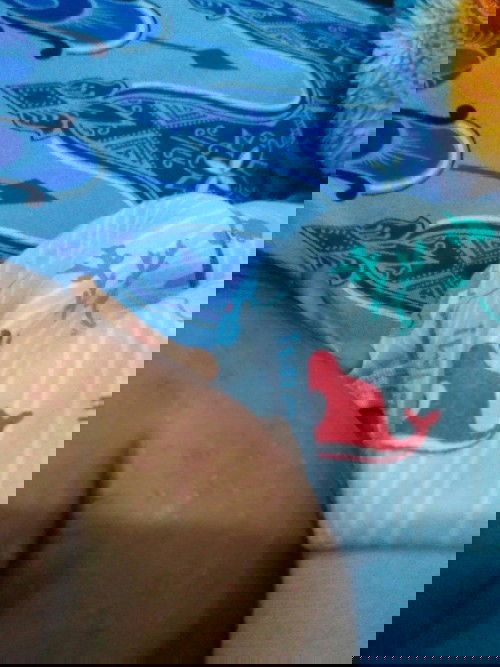 Suka ngeden dan bruntusan