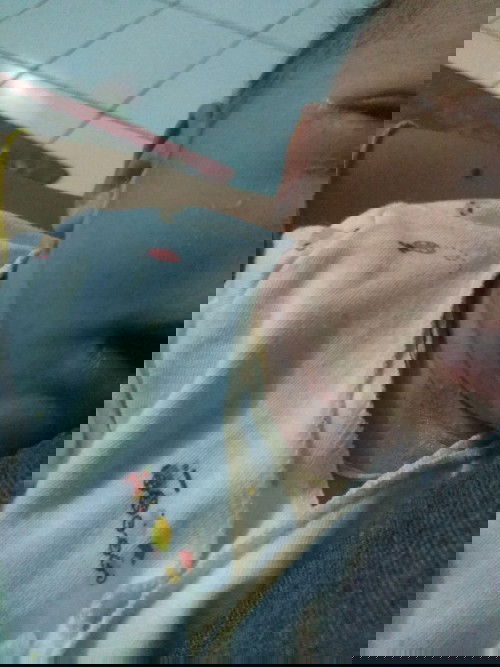 Bun kl ruam merah di kulit bayi kira" sembuhnya pake apa yahh