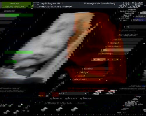 Sinh sản ( Chuột 16/11 )