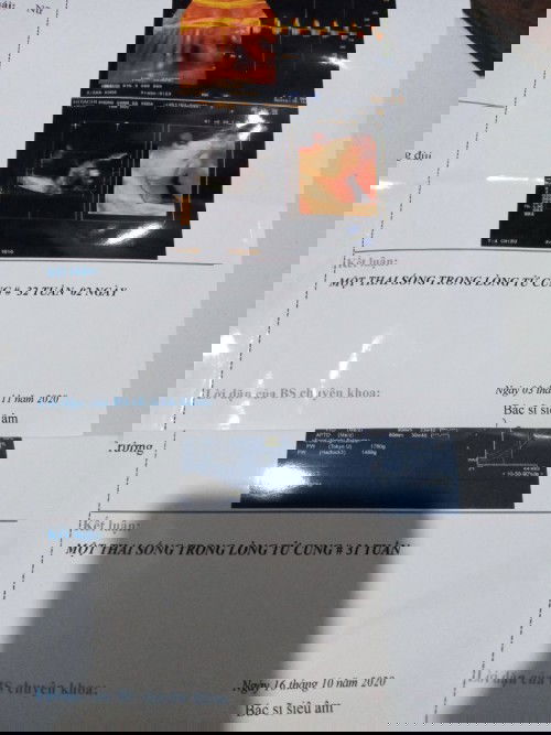 Thai bị sụt tuần tuổi