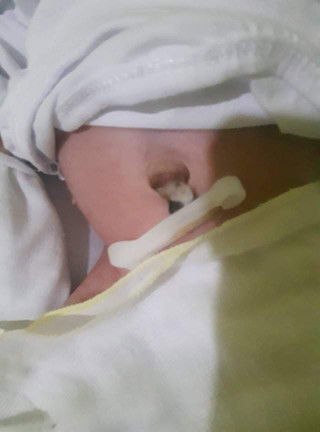 Bulak sa Pusod ni Baby