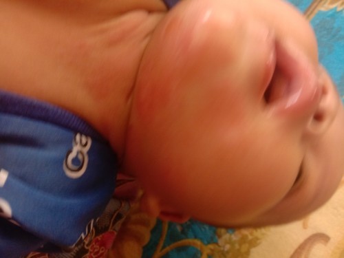 แพ้อะไรค่ะ