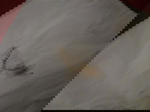 Dua hari lalu sempetflak sedikit 1 tetes coklat muda earnanya karena panik langsung ke dokter