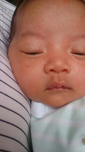 Baby ku udah 2hri ini bintik2 merah, ada yg tau ngg bund disebabkan krna apa dan pengobatannya gimna