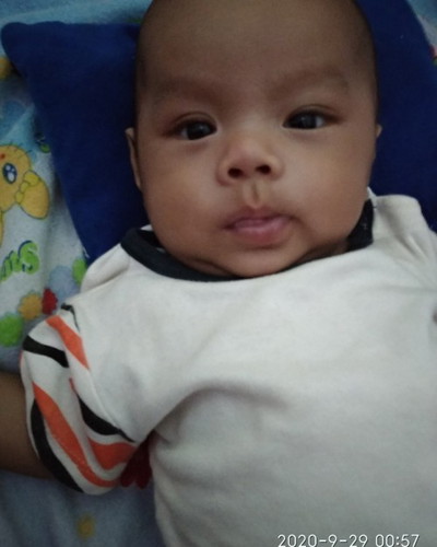 bun adakah yg seperti anak sya usia 3bln 17 hri blm bisa menyangga kepala dengan mantap