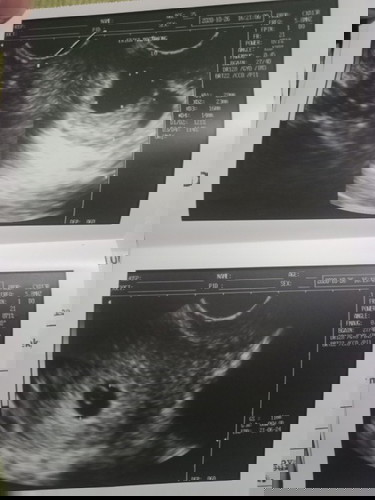 7weeks 3day