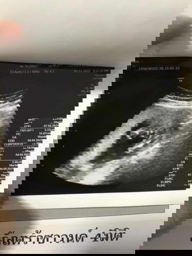 18w+3d ซาวครั้งแรก