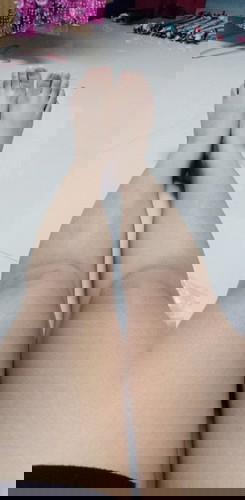 สอบถามอาการบวมค่ะ