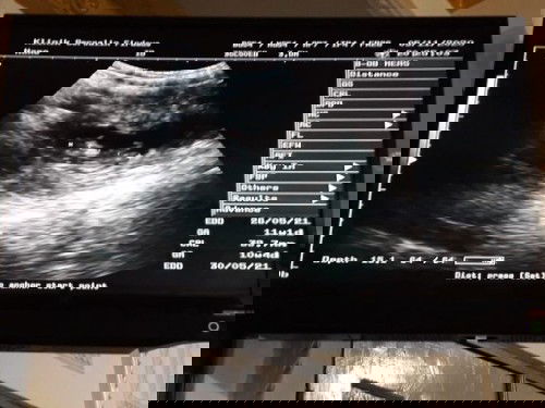 keluar darah seperti haid