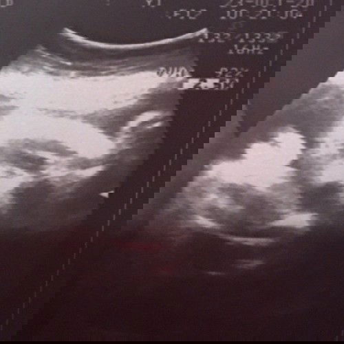 แม่ๆช่วยดูให้หน่อยค่ะ