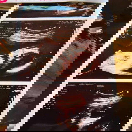 เพศอะไรคะ🥰