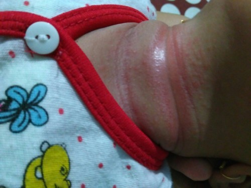 leher merah