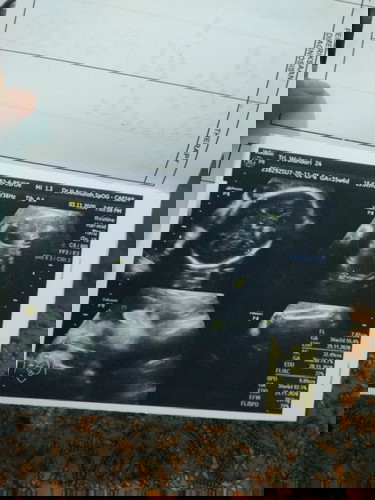 Bun aku mau nanya, usia kehamilan ku 36 w tpi posisi kepala masi di atas, apa kah masi bisa mutar?