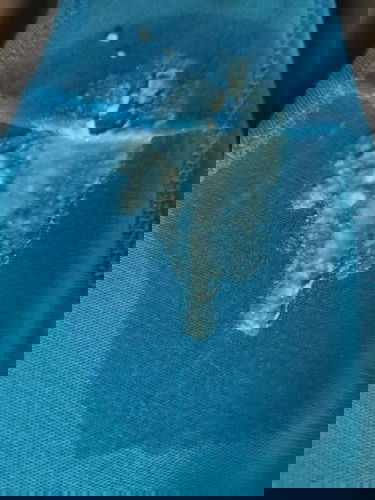 Preggy 23w Discharge