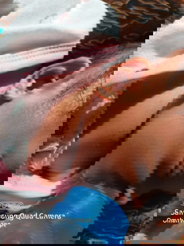 Leher bintik2 merah