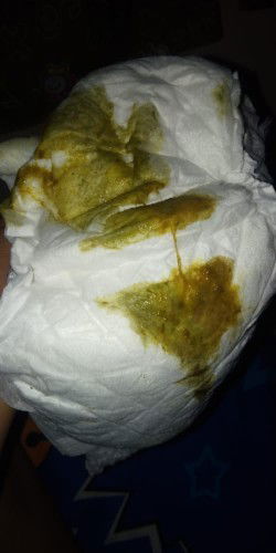 Warna pup bayi, Yang jijik jgn dibuka