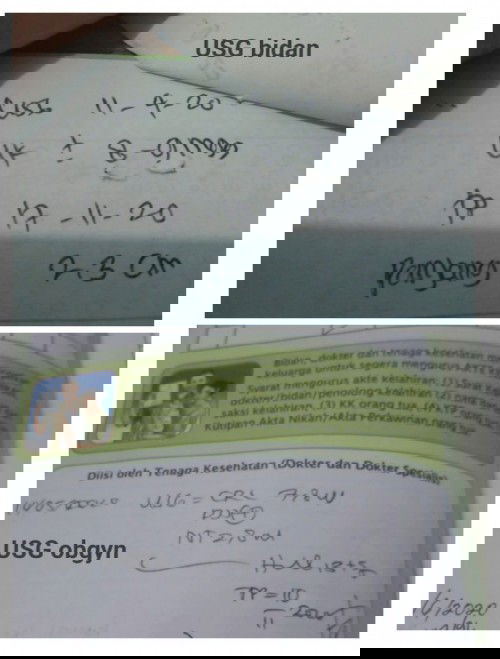 Pilih hpl yang mana?