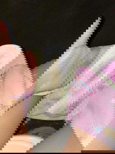 vaginal discharge