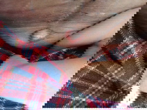 ใครผ่าคลอดเเล้วปูดบวมเเบบนี้บ้างคะ??