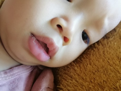ลูกชาย11เดือน9วันปากเป็นคราบขาวไม่ทราบว่าใครมีประสบการณ์เคยเป็นและดูแลรักษายังไงบ้างคะ