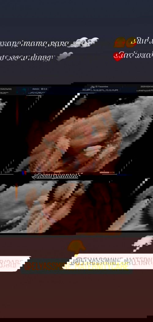 Melahirkan pakai BPJS