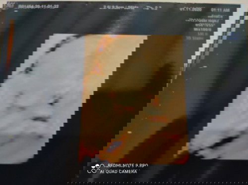 Minum air dingin bikin bayinya besar di dalam