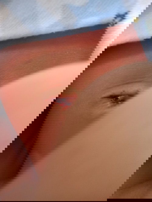 สะดือมีเลือด(น้องเป็นผู้ชาย)