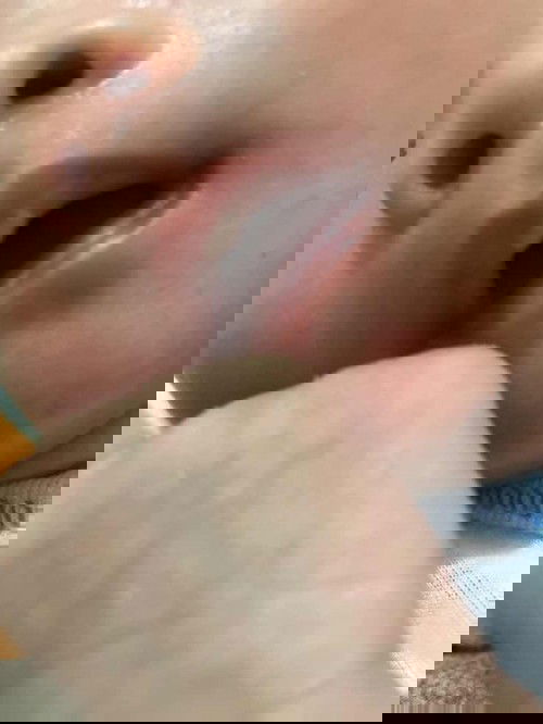 Melentung di bibir atas