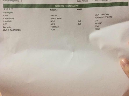 Stool exam result