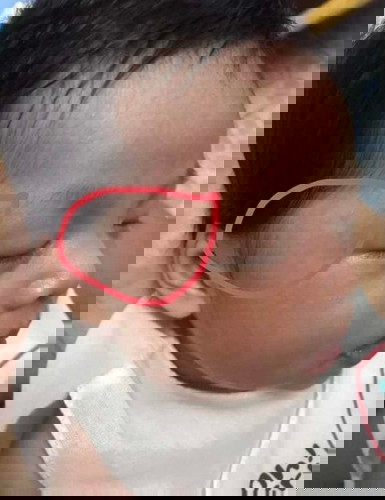 ใครเคยมีอาการนี้มั้ยคะ??