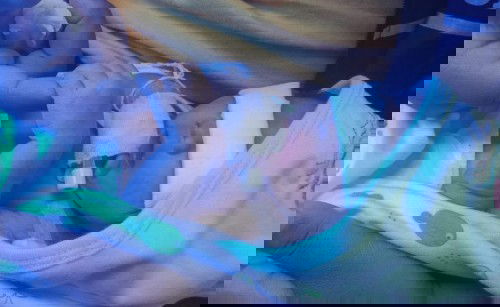 คลอดแร้วครับก่อนกำหนด